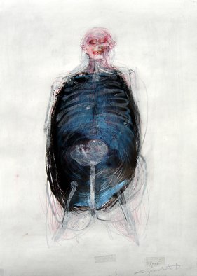 Milija Stojanovic; Anatomy Of Pain, 2008, Original Collage, 25 x 35 cm. Artwork description: 241 Anatomy of pain, 25x35cmcollage acrylic and X- ray plastic...